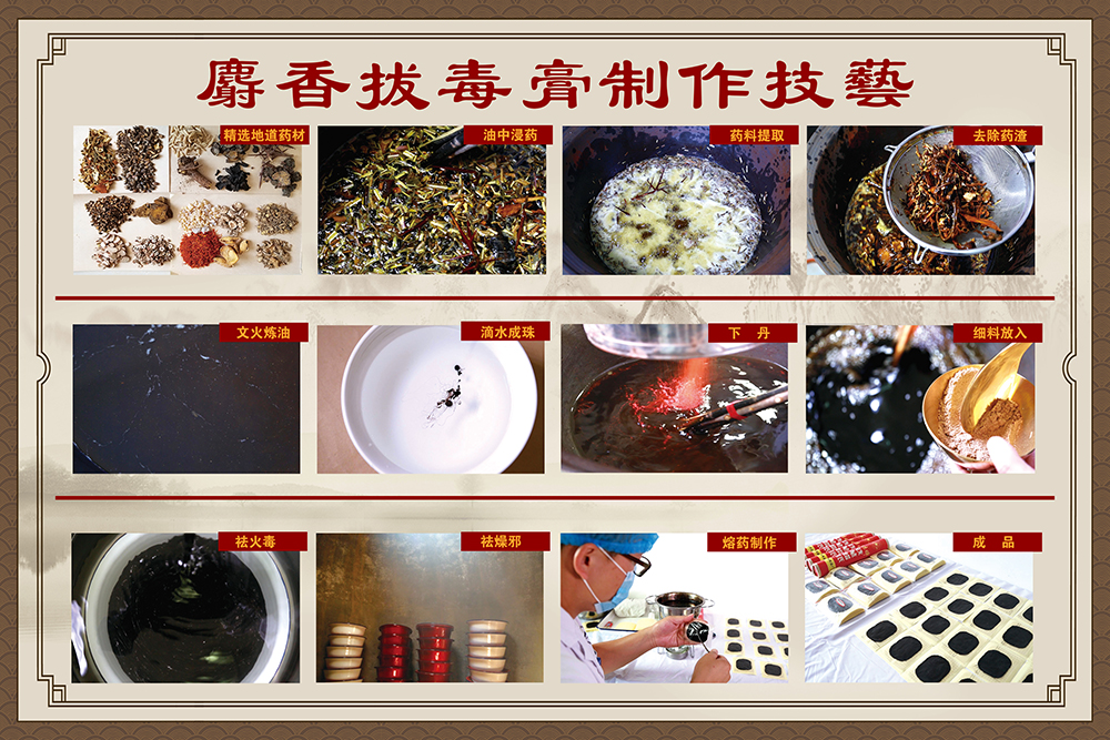 把“非遗名医”请回家：九色视频
上门服务，让重度褥疮患者重获新生